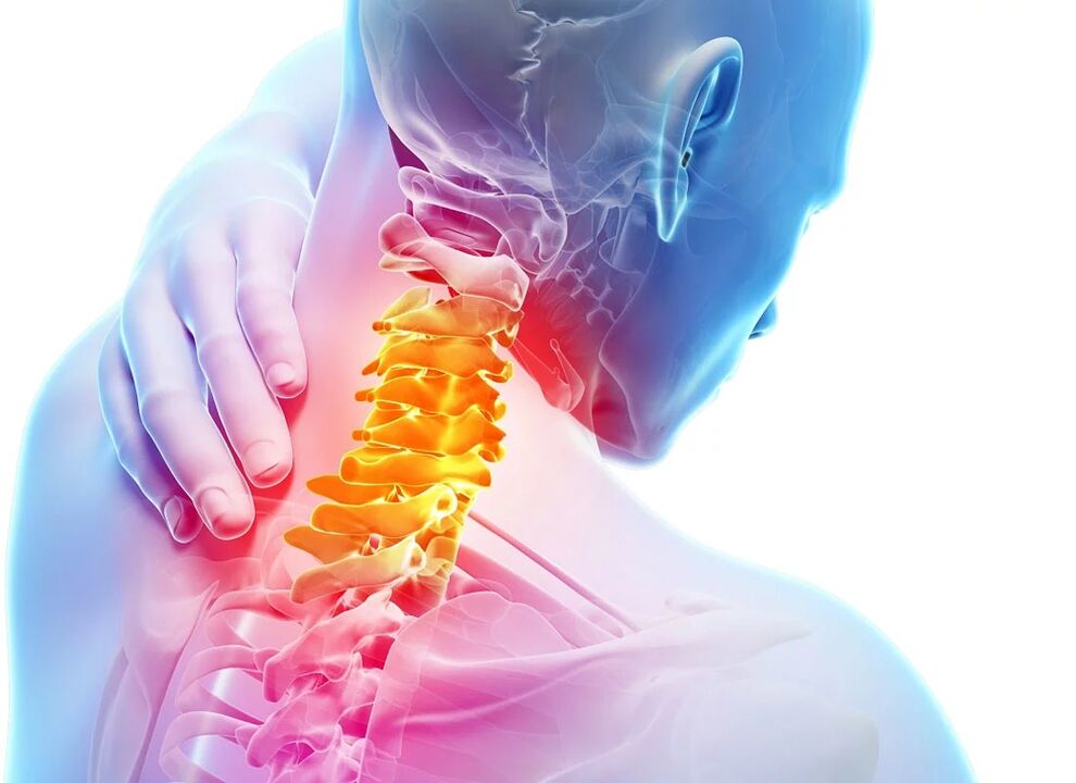 Osteochondroza szyjka macicy