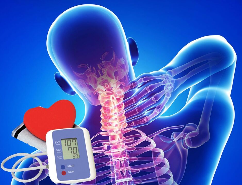 Połączenie ciśnienia krwi w przypadku osteochondrozy szyjnej