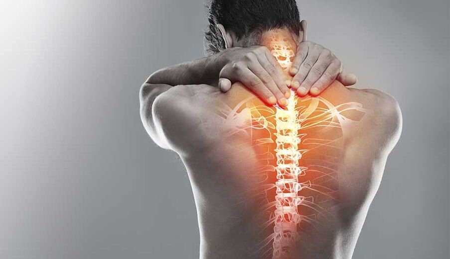 Ból kręgosłupa z powodu osteochondrozy