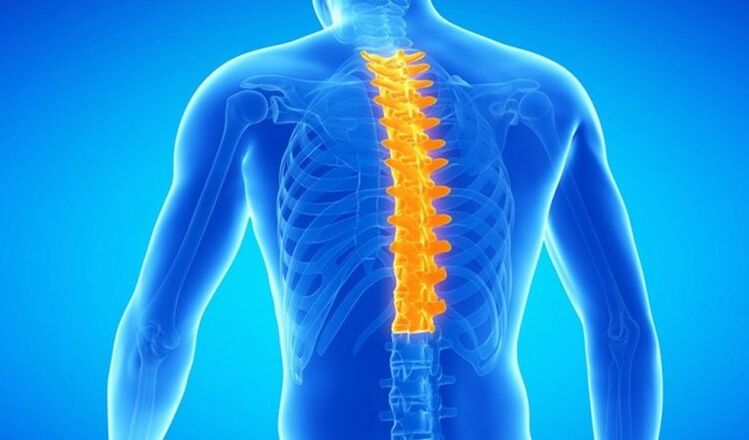 Osteochondroza odcinka piersiowego kręgosłupa