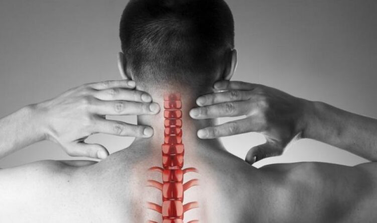Wyraźny ból w zespole neurologicznym